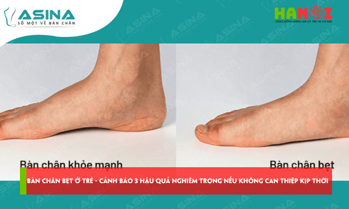 Ban-chan-bet-o-tre-chuyen-gia-canh-bao-3-hau-qua-nghiem-trong-neu-khong-can-thiep-kip-thoi-hanoitoplist