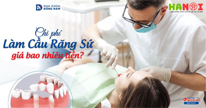 Lam-cau-rang-su-co-dat-khong-loi-khuyen-tu-chuyen-gia-nha-khoa-2-hanoitoplist