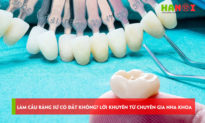 Lam-cau-rang-su-co-dat-khong-loi-khuyen-tu-chuyen-gia-nha-khoa-hanoitoplist