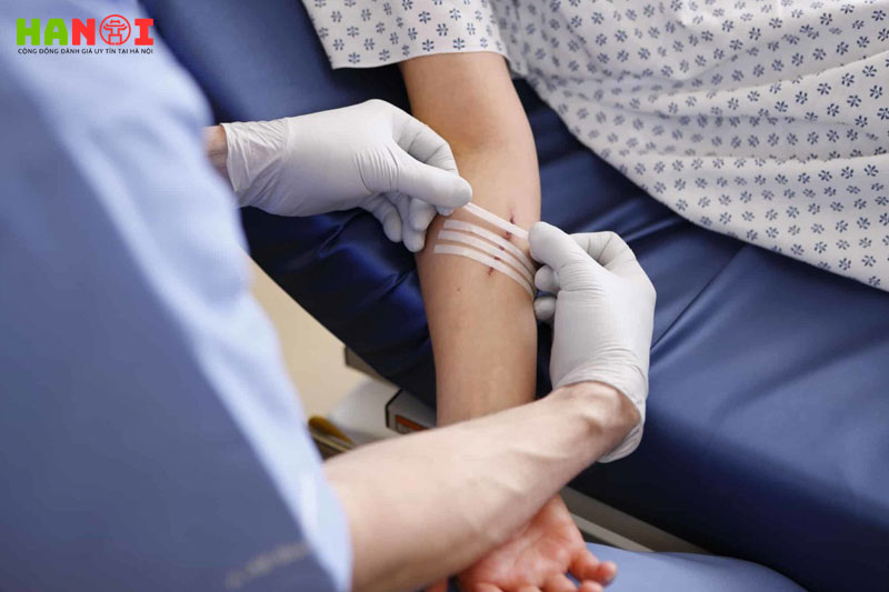 Tai-sao-can-thay-bang-va-cat-chi-vet-thuong-dung-cach-2-hanoitoplist