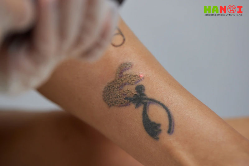 Benh-vien-tham-my-kangnam-hanoitoplist