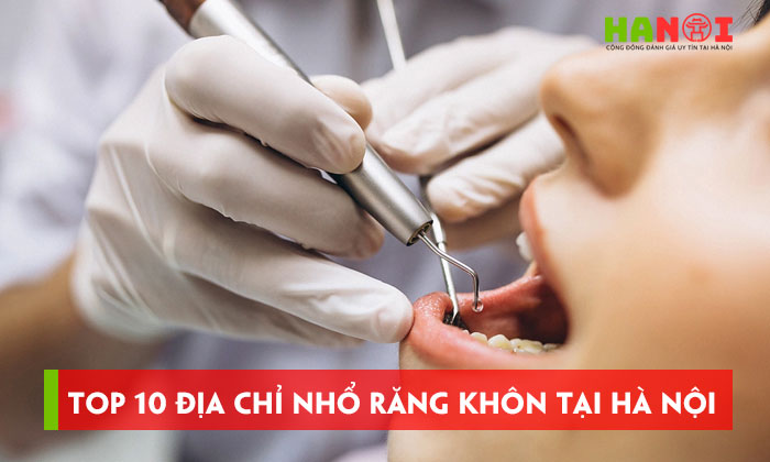 Top-10-dia-chi-nho-rang-khon-tai-ha-noi-an-toan-it-dau-hanoitoplist