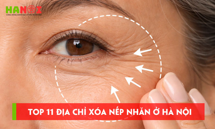 Top-11-dia-chi-xoa-nep-nhan-o-ha-noi-cong-nghe-hien-dai-hanoitoplist