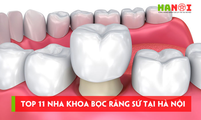 Top-11-nha-khoa-boc-rang-su-tai-ha-noi-mang-lai-nu-cuoi-rang-ro-hanoitoplist